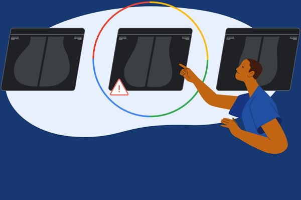 An illustration of a doctor pointing to mammogram results, one of which is circled with a caution symbol.