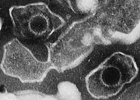 Electron micrograph of two Epstein–Barr virus particles