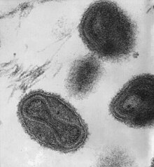 This transmission electron micrograph depicts a number of smallpox virions. The "dumbbell-shaped" structure inside the virion is the viral core, which contains the viral DNA; Mag. = ~370,000×