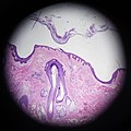 Scalp cross section showing hair follicle with sebaceous glands.