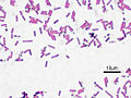 Imagen microscópica de Bacillus subtilis (ATCC 6633). Tinción de Gram, ampliación: 1.000. Las estructuras ovaladas no teñidas son esporas.