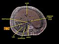 Cross section of stomach wall.