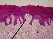 Ein Meissner-Körperchen (Spitze des schwarzen Zeigers) im Lichtmikroskop. Seine Lokalisation im Stratum papillare des Coriums ist gut zu erkennen.