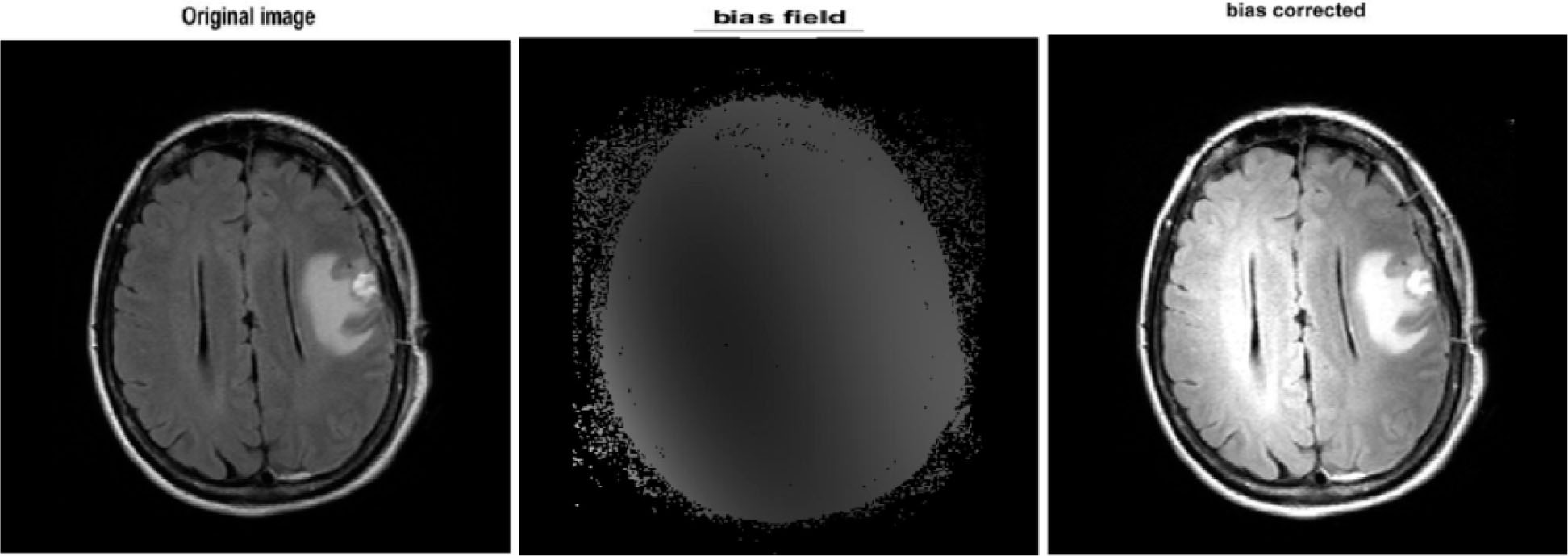 Figure 2 MICO bias corrections